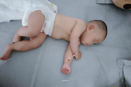 蓬莱宝宝头上长痱子